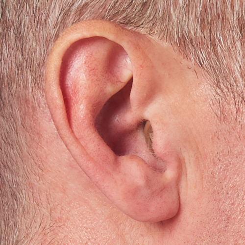https://www.audibelhearing.com/-/media/Products/in-ear-shots/completely-in-canal-hearing-aid-genesis-in-ear.png