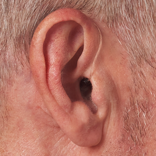 Micro Receiver-In-Canal Hearing Aid in ear